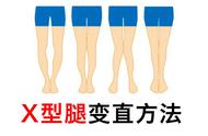How to correct X leg, what good method is recommen